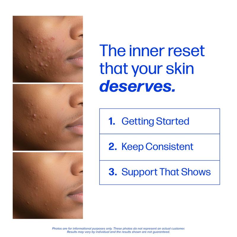 Telora Clear3™ Acne & Skin Support