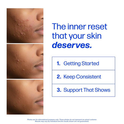 Telora Clear3™ Acne & Skin Support
