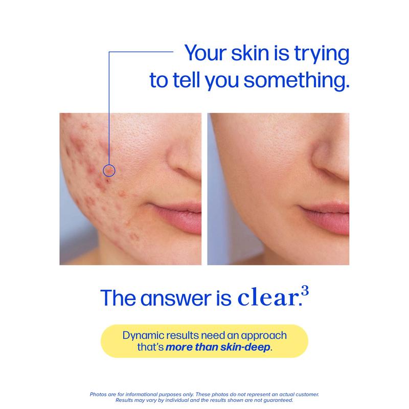 Telora Clear3™ Acne & Skin Support